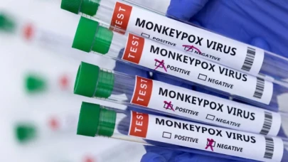 DSÖ: Küresel maymun çiçeği vakaları 70 binin üzerinde