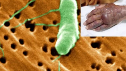 Et yiyen bakteri vakaları artış gösteriyor