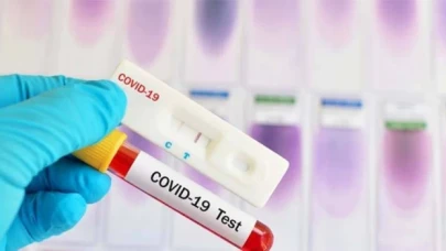 İddia: ”Covid-19 sebebiyle ölenlerin beyninde virüs saptandı”