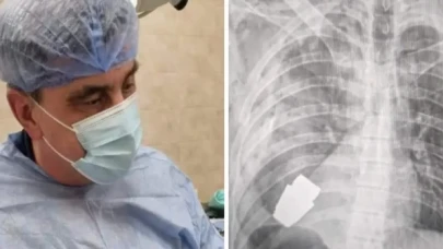 Ukraynalı askerin göğsünden patlamamış el bombası çıkarıldı!