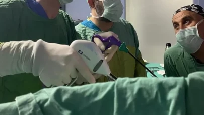 Korktuğu için 20 yıldır ameliyat olmadı, safra kesesinden 2 bin taş çıkarıldı