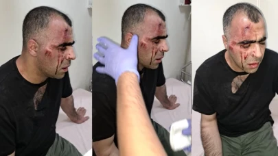 Gazeteci Sinan Aygül: Tatvan belediye başkanının korumalarının saldırısına uğradım