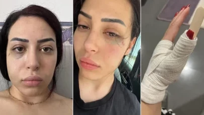 Güney Kıbrıs'ta 25 yaşındaki Türk kızına saldıran 2 Rum tutuklandı