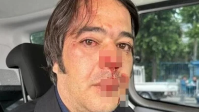 İBB'nin imar şube müdürüne saldırıda tutuklanan şüpheli serbest bırakıldı