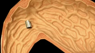 İnsan vücudu içinde yüzebilen minik bir robot geliştirildi