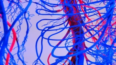 Damar tıkanıklığı tedavisinde yeni nesil yöntemler!