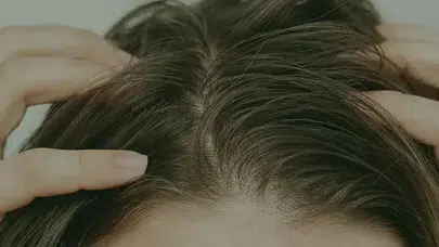 Yağlı saç derdi bitti! Uzmanlardan saçın yağlı görünmemesi için etkili tüyolar