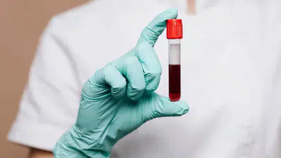 Dünyanın en nadir kanı laboratuvarda üretildi: “Altın kan” tıp dünyasında devrim yaratacak