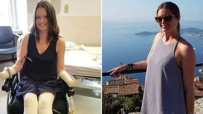 Korkunç vaka: Yanağındaki ağrı uzuvlarının kesilmesine yol açtı