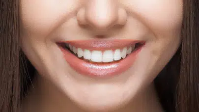 Çürükleri önleyecek devrim: Diş minesini onaran jel geliştirildi