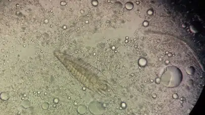 Siz uyurken yüzünüzde dolaşan misafirler: Demodeks gerçeği