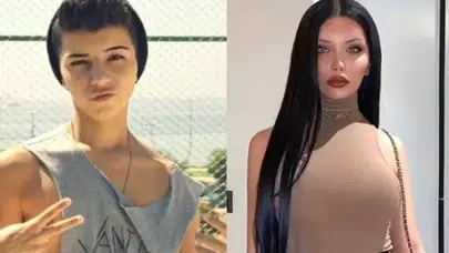 Cinsiyet değiştiren fenomen Beren Güney’den dikkat çeken estetik itirafı: Kemik eklettim