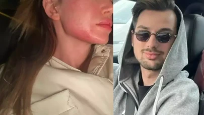 Danla Bilic'i darbeden eski sevgilisi Berk Çetin tutuklandı