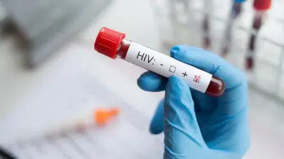 HIV vaka sayısı 10 yılda 4 kat arttı: Uzmanlardan test ve farkındalık çağrısı