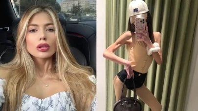 Bir deri bir kemik kalan Nihal Candan, kilosunu soran muhabire çıkıştı: Hayvanların...