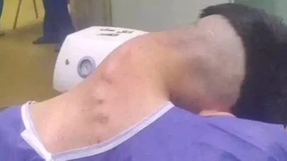 Bağımlılığın şok edici sonu: 23 yaşındaki genç 'baş düşmesi' sendromuna yakalandı