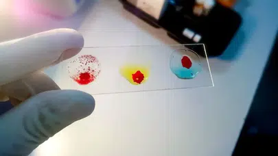 Fransa’da keşfedildi: Dünyanın 48. kan grubunun tek taşıyıcısı bir kadın