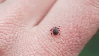 Kene ısırması belirtileri nelerdir? Kene ısırığı olduğu nasıl fark edilir?