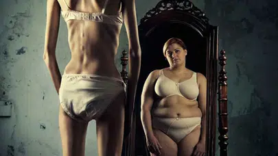 Anoreksiya nervoza, kilo kaybından çok daha fazlası