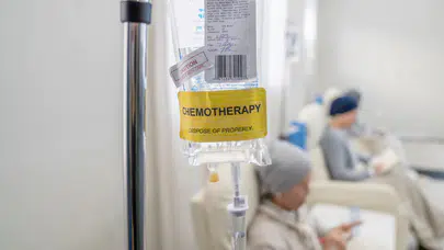 Kemoterapiye bağlı saç dökülmesine karşı “soğutma ve antioksidan”lı yeni yöntem