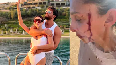 Can Yaman’ın sevgilisi Sara Bluma eski partneri tarafından şiddet gördüğünü açıkladı