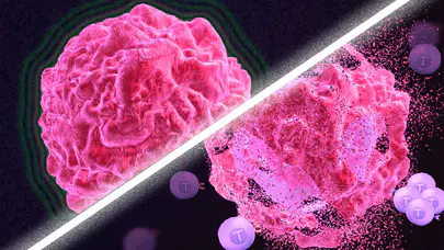 Kanser ölümleri önümüzdeki 25 yılda yüzde 75 artabilir