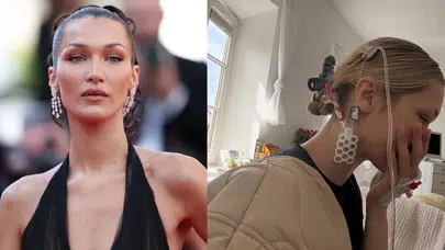 Bella Hadid, Lyme hastalığıyla mücadelesini paylaştı: Hep ortadan kayboluyorum