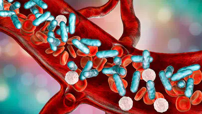 Enfeksiyonlarda hayati tehlike: Sepsis belirtilerine dikkat!
