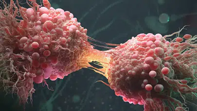 Masum sanılıyor ama kanserin ilk sinyali olabilir: Bu belirtiler gözden kaçıyor