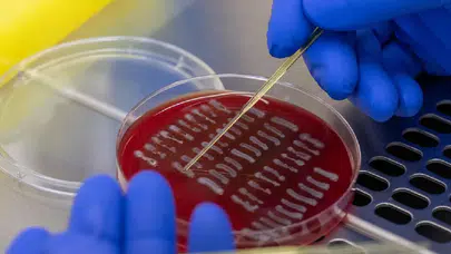 Bağırsaklar alkol üretiyor: İçmeden sarhoş eden “otomatik bira üretme sendromu”