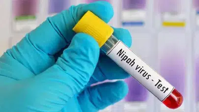 Hindistan Nipah virüsü: Türkiye'de var mı, nedir, nasıl bulaşır, aşısı var mı?