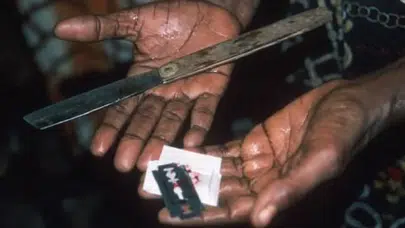 Ürküten gerçek: Dünyada 230 milyon kadın genital sakatlamaya maruz kaldı