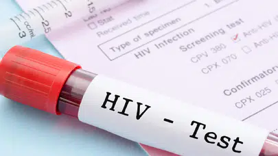 Eşinden HIV pozitif olduğunu gizledi: 10 ay hapis cezası onandı
