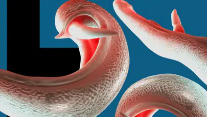 Cinsel organlara kadar ulaşıyor: Yıllarca fark edilmeyen parazit için küresel alarm