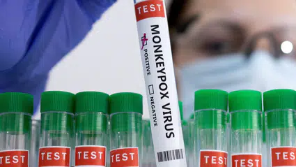 Belçika'da M çiçeği virüsünün yeni varyantı tespit edildi