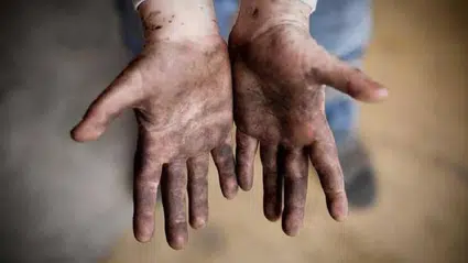 Tekirdağ’da 16 yaşındaki çocuk işçi çalıştığı fabrikada tenekedeki ateşle ısınmaya çalışırken yanarak öldü!