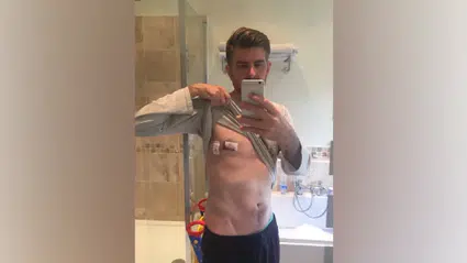 Erkeklerde meme kanseri uyarısı