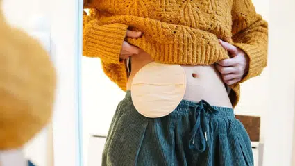 Kolostomi torbası nedir, neden takılır? Kimler kullanır, ne işe yarar?