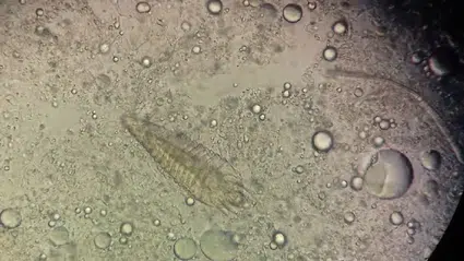 Siz uyurken yüzünüzde dolaşan misafirler: Demodeks gerçeği