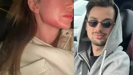 Danla Bilic'i darbeden eski sevgilisi Berk Çetin tutuklandı