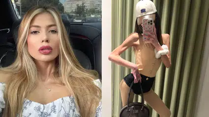 Bir deri bir kemik kalan Nihal Candan, kilosunu soran muhabire çıkıştı: Hayvanların...