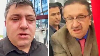 AK Partili Belediye Başkanı Veysel Tiryaki ve yardımcıları işçiyi darbettiği iddia edildi