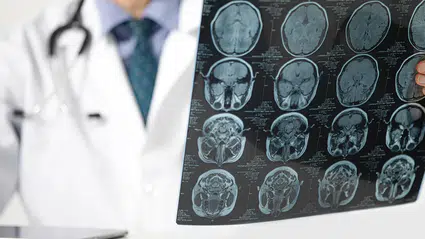 ALS hastası adam beyin çipiyle yeniden konuşmaya başladı
