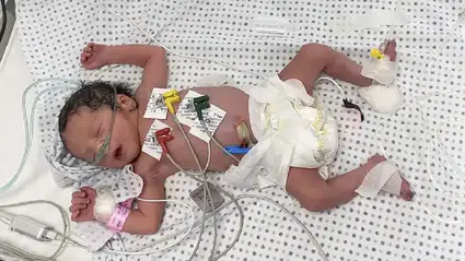 Gazze’de bebek mamaları tükendi: 48 saat içinde ölüm vakaları görülebilir