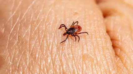 Türkiye'de ilk kez tespit edilen kene türü 30'dan fazla hastalık taşıyor