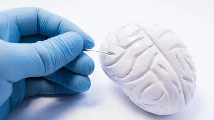 Covid-19 beyni yaşlandırıyor, hastalığı geçirmeyenlerde bile etkisi var