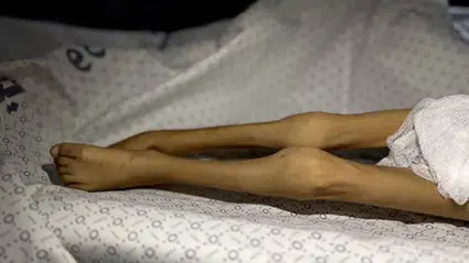 BM’den Gazze uyarısı: Açlık ölümleri ‘sıradanlaştı’, sağlık sistemi yok ediliyor