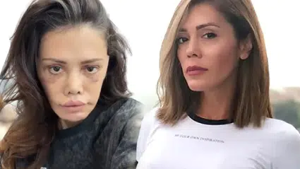 Yüz nakli yaptırmasıyla gündem olan Didem Ceran, ağlayarak hastalığını açıkladı