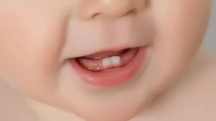 Bebeklerin ilk dişiyle ilgili şaşırtan keşif: Anne hormonları belirleyici oluyor
