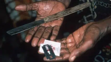 Ürküten gerçek: Dünyada 230 milyon kadın genital sakatlamaya maruz kaldı